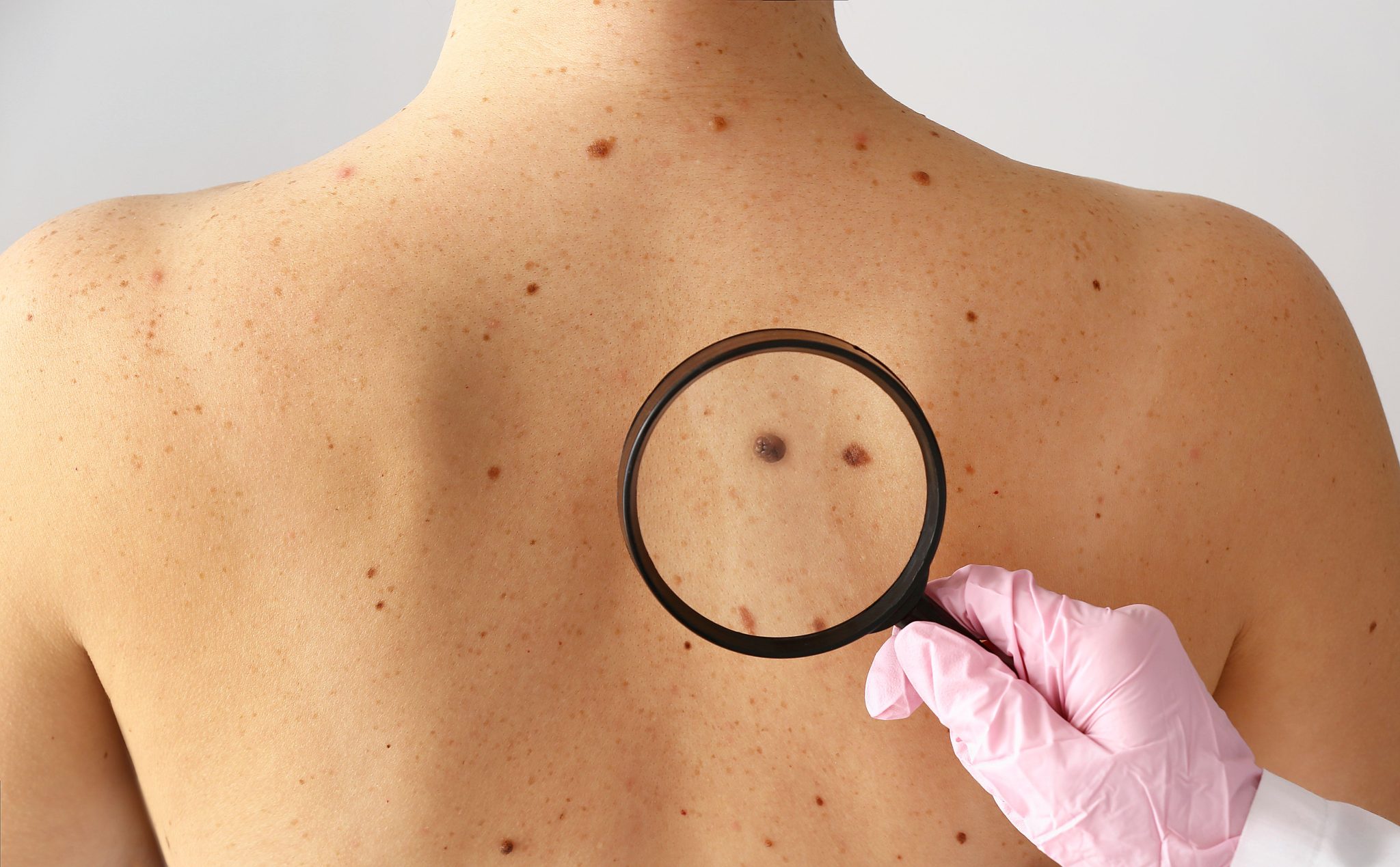 Skin Check